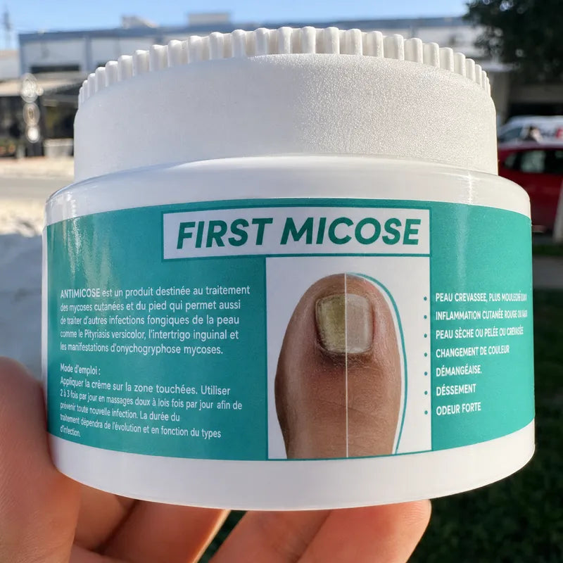 FIST MICOSE