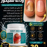 FIST MICOSE