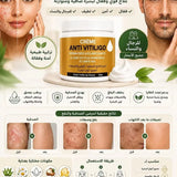 ANTI VITILIGHO CREAM