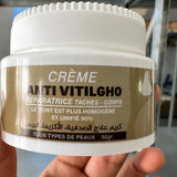 ANTI VITILIGHO CREAM
