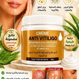 ANTI VITILIGHO CREAM