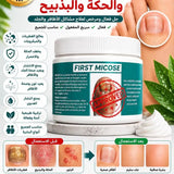 FIST MICOSE